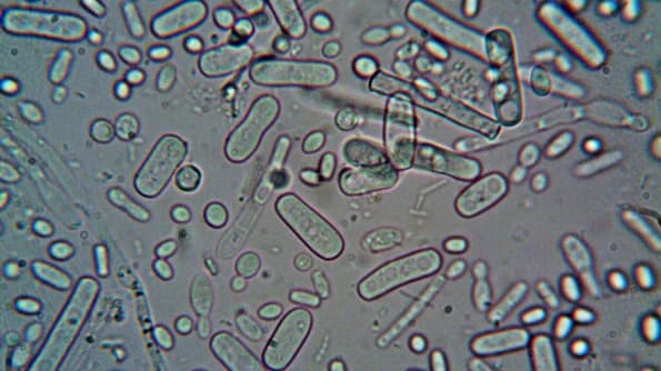 En Sık Görülen Hastalıklar ve Nedenleri!